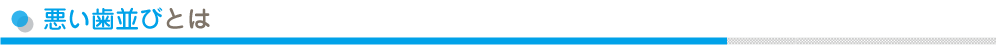 悪い歯並びとは
